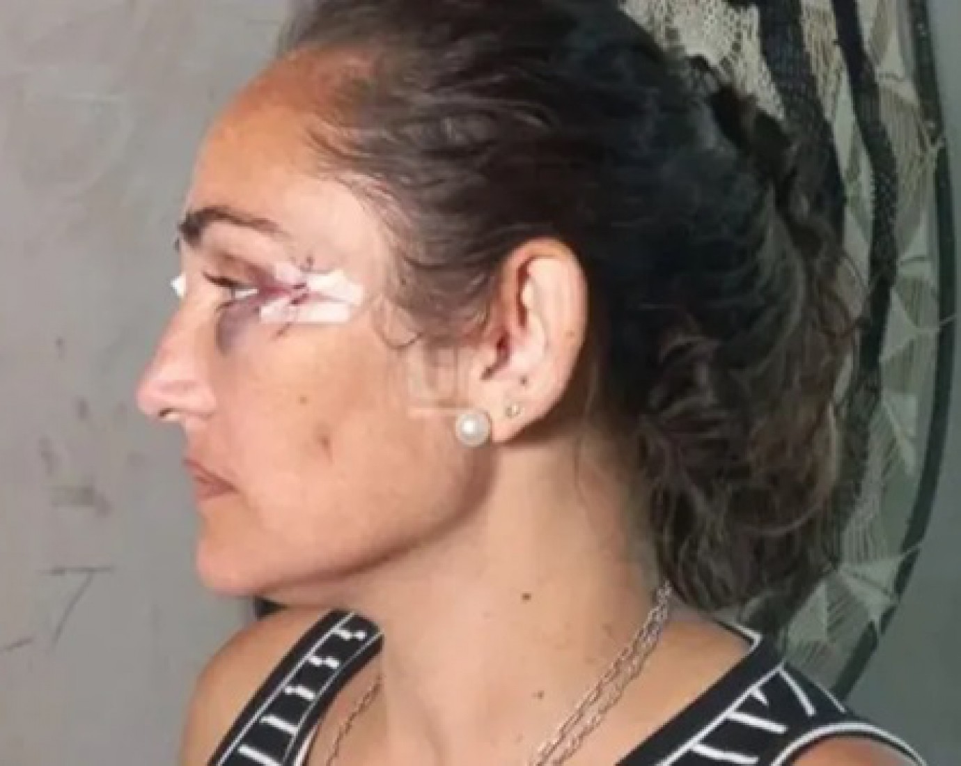 Dos mujeres detenidas por intentar matar a la hermana de un intendente de Santa Fe