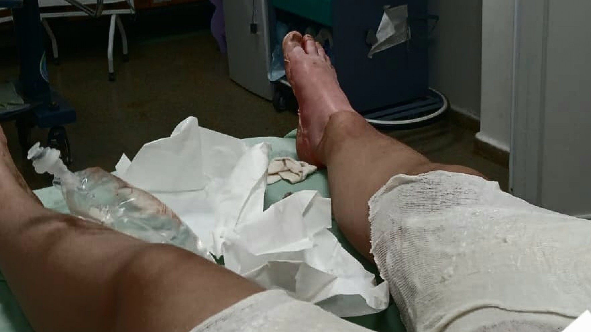 Natasha sigue internada por graves quemaduras y su mamá pide ayuda para afrontar el tratamiento