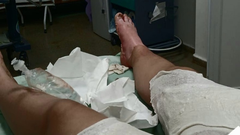 Natasha sigue internada por graves quemaduras y su mamá pide ayuda para afrontar el tratamiento