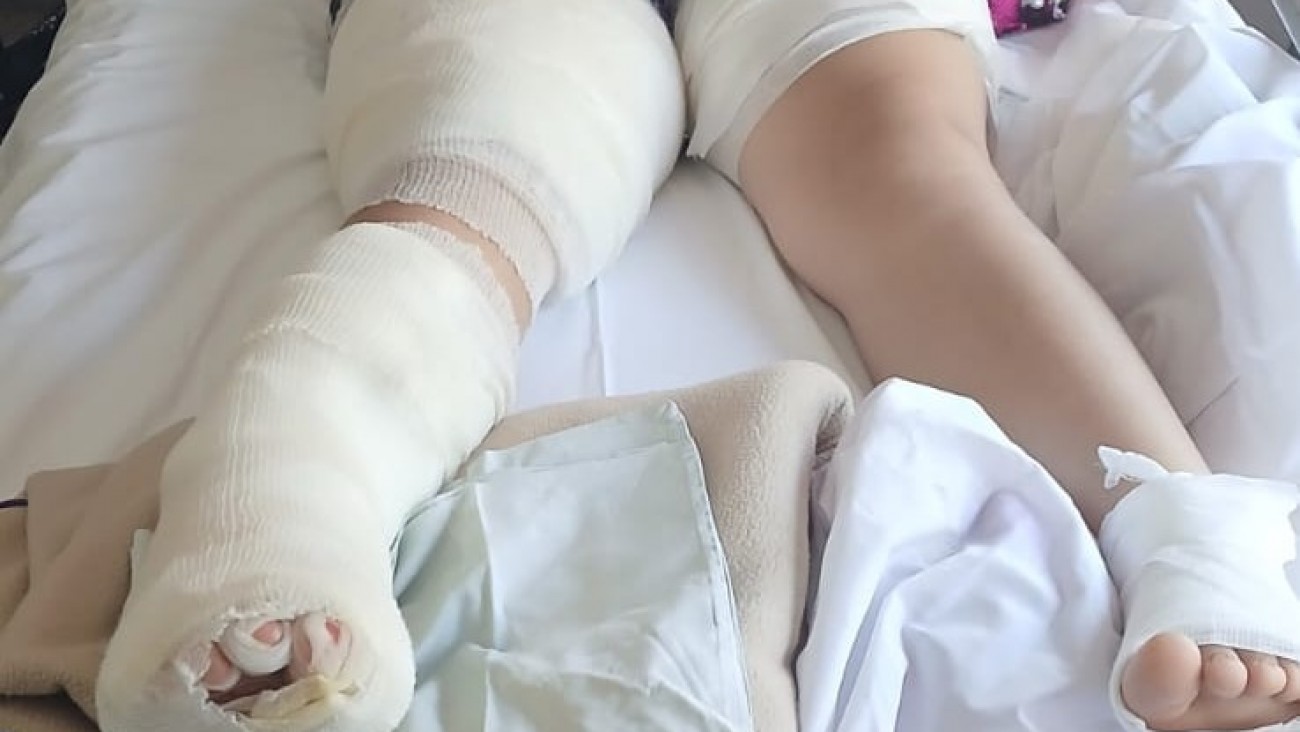 Natasha tiene 12 años, sufrió graves quemaduras y necesita una silla de ruedas para su recuperación