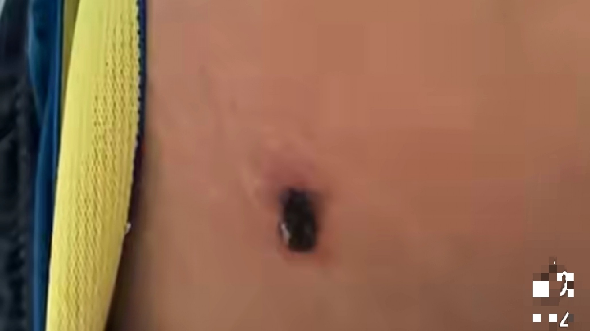 Robaron celulares en una fiesta clandestina y todo terminó a los tiros: hay dos heridos, uno menor de 15 años, e imputaron a un joven