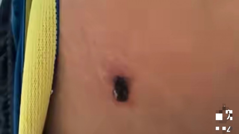 Robaron celulares en una fiesta clandestina y todo terminó a los tiros: hay dos heridos, uno menor de 15 años, e imputaron a un joven