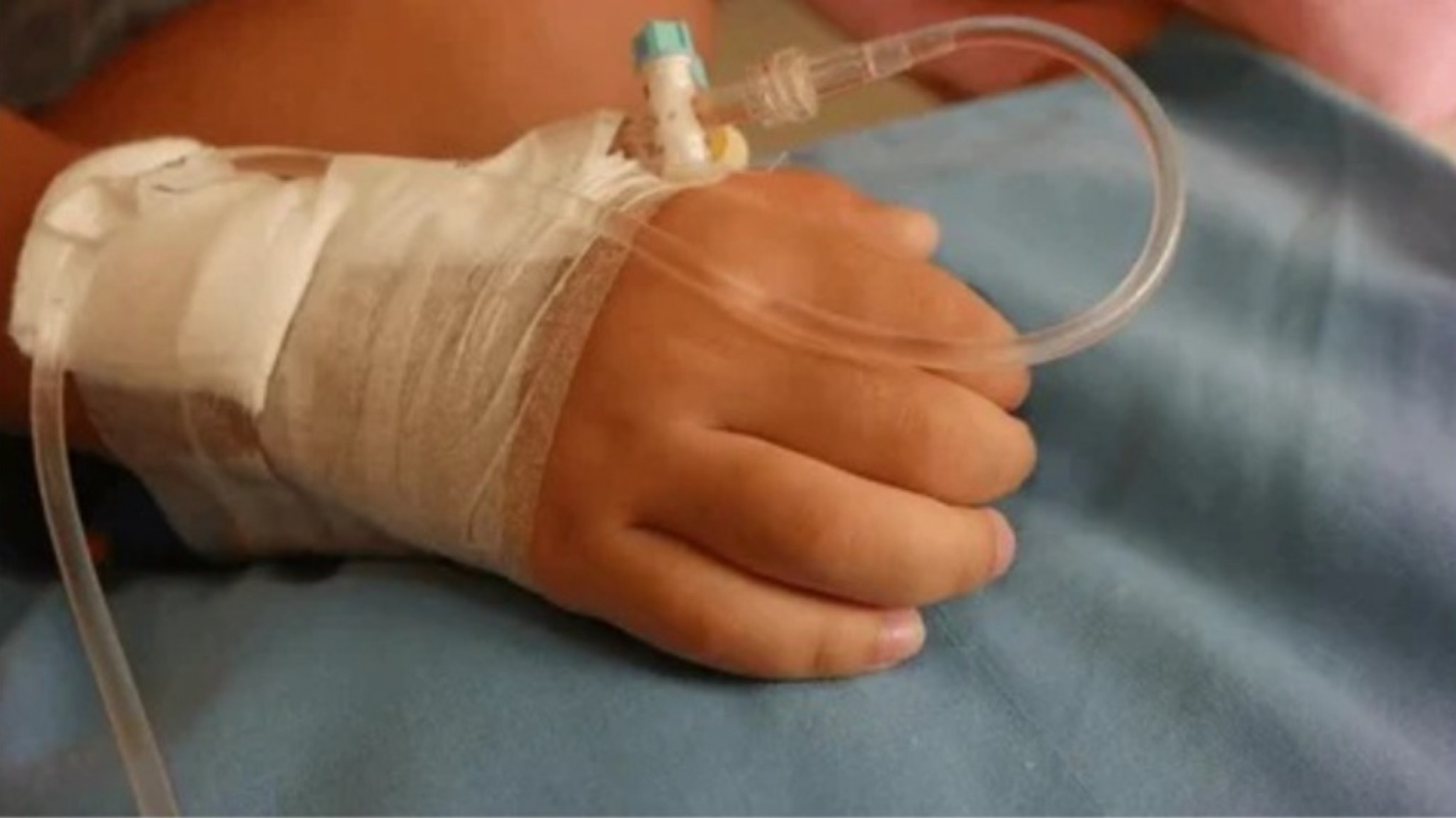 Un nene de 3 años lucha en terapia con el 50% del cuerpo quemado: qué se sabe del incendio