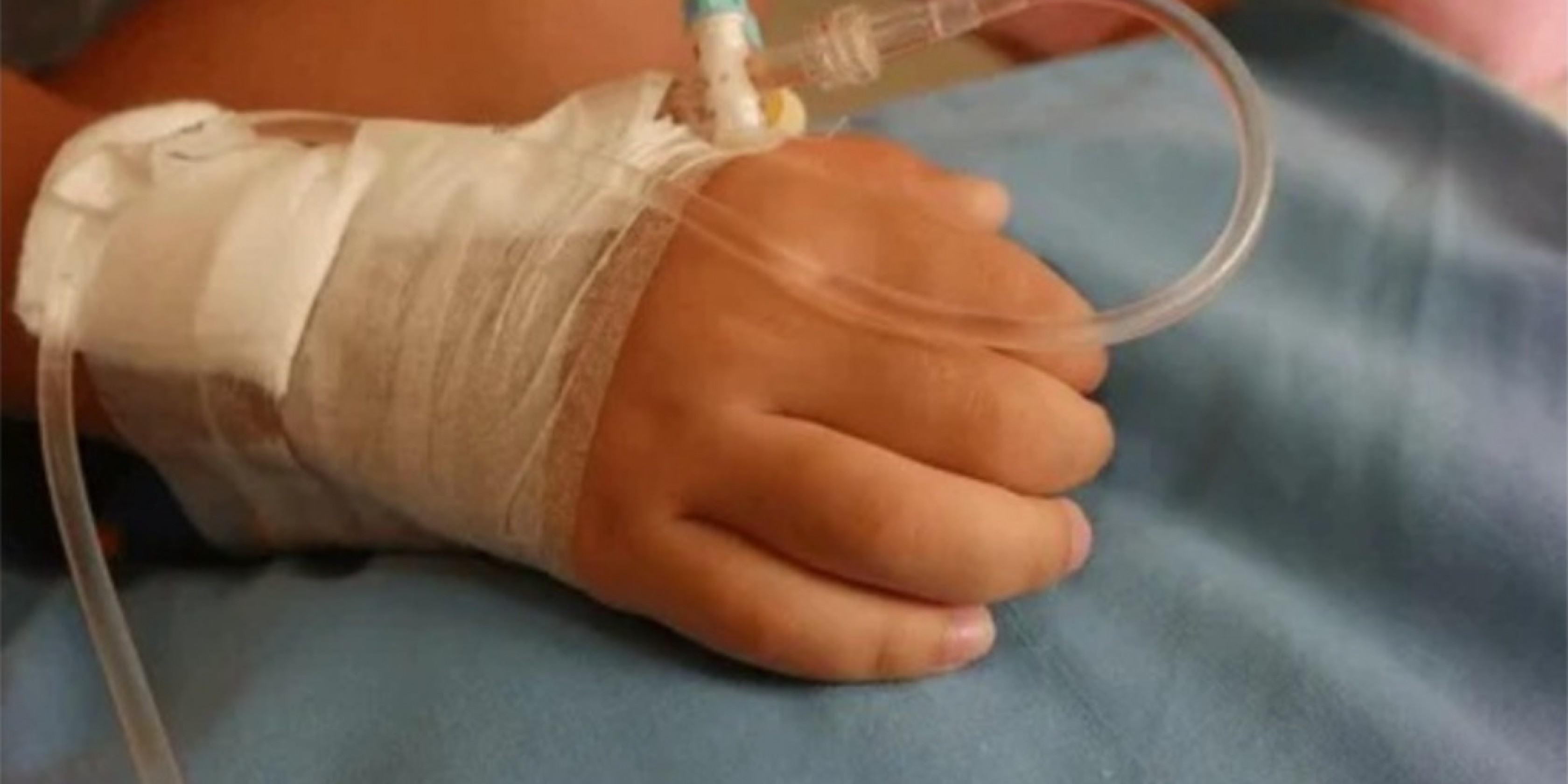 Un nene de 3 años lucha en terapia con el 50% del cuerpo quemado: qué se sabe del incendio