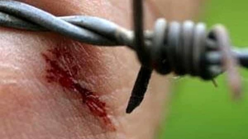 Alerta en Santa Fe: una nena de 5 años está en terapia intensiva por un caso de tétanos