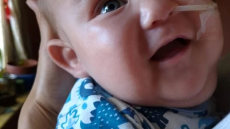 Dolor en Comodoro Rivadavia: murió un bebé con síndrome de Prune Belly tras permanecer internado