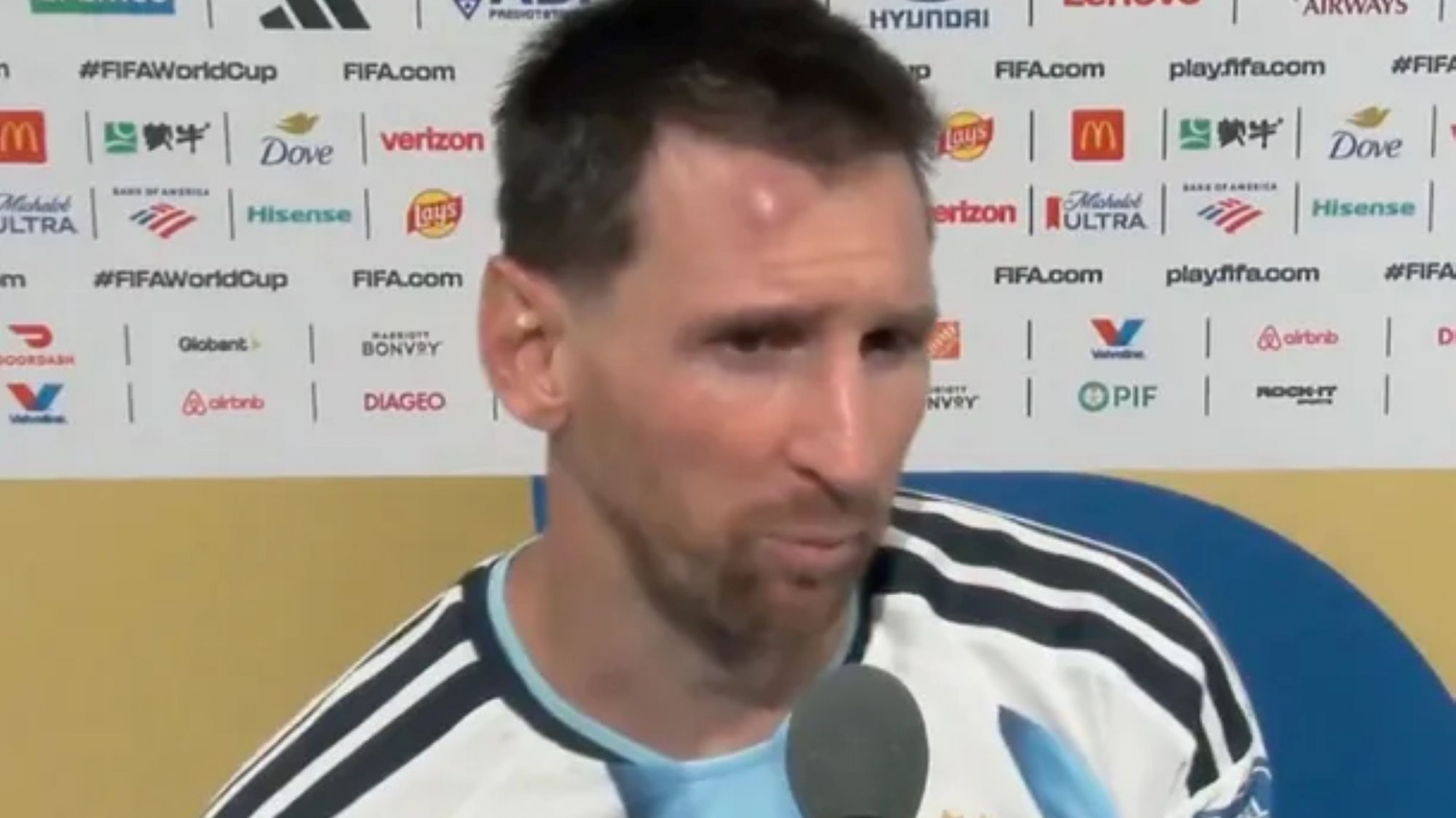 Lionel Messi terminó con un chichón en la cabeza tras el duelo ante Cabo Verde: qué le pasó y cómo está