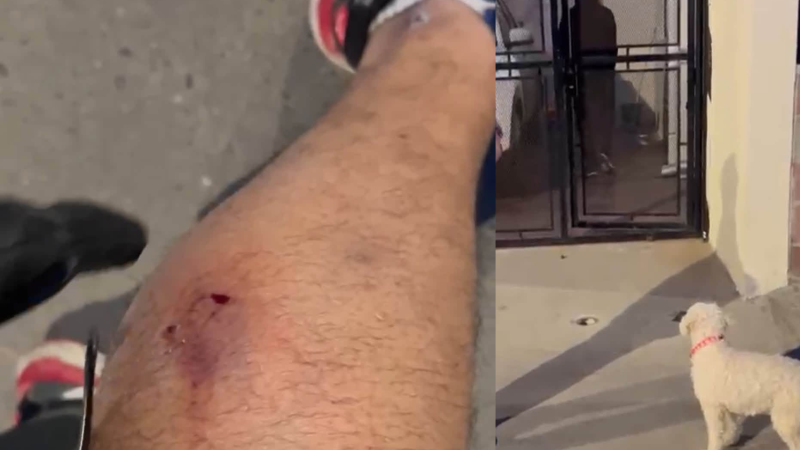 Denuncian que un perro mordió a un vecino en Km 5 y aseguran que ya había protagonizado otros ataques