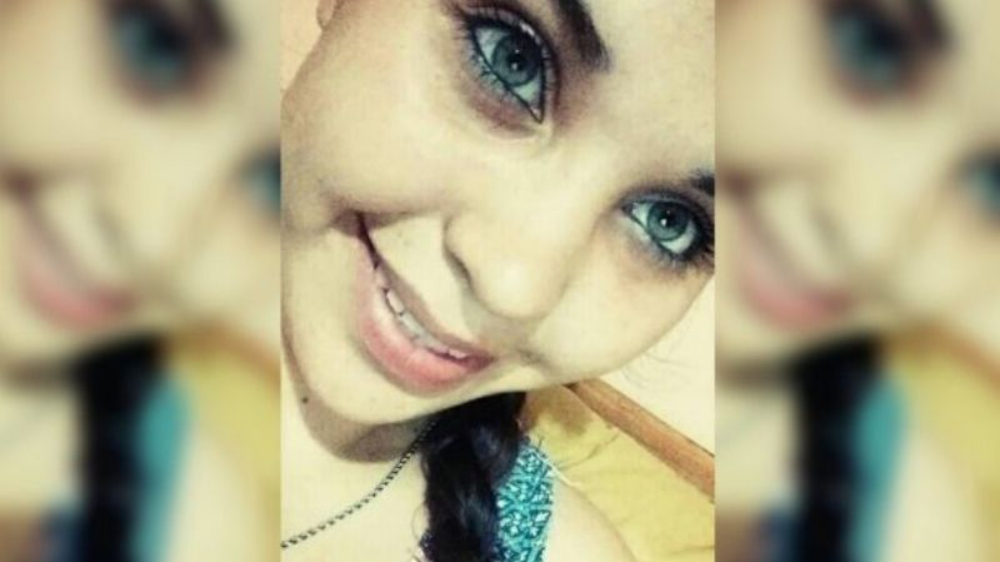 Intento de Femicidio: Su marido la prendió fuego, tiene el 80% del cuerpo quemado