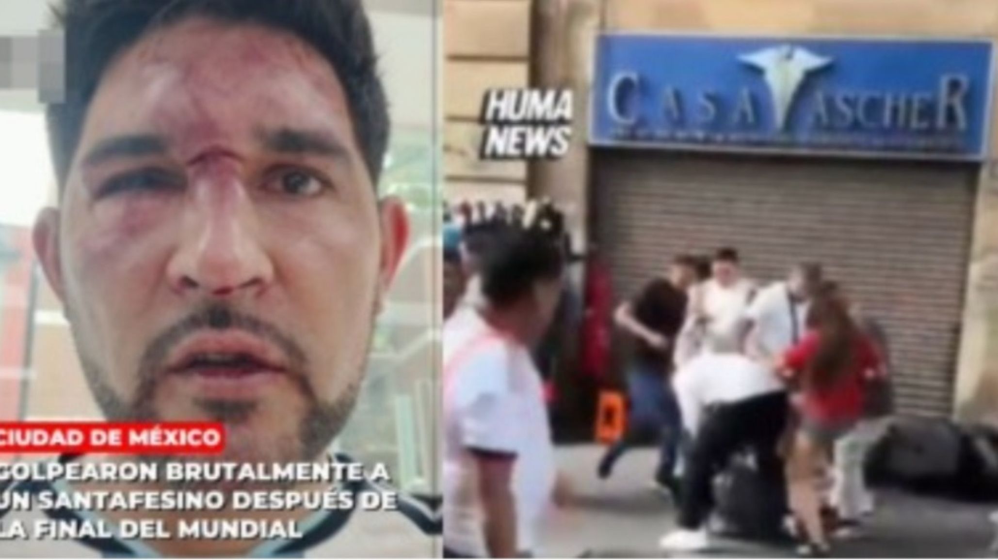 Brutal ataque a un argentino en México tras la final del Mundial: ahora denuncia amenazas de muerte
