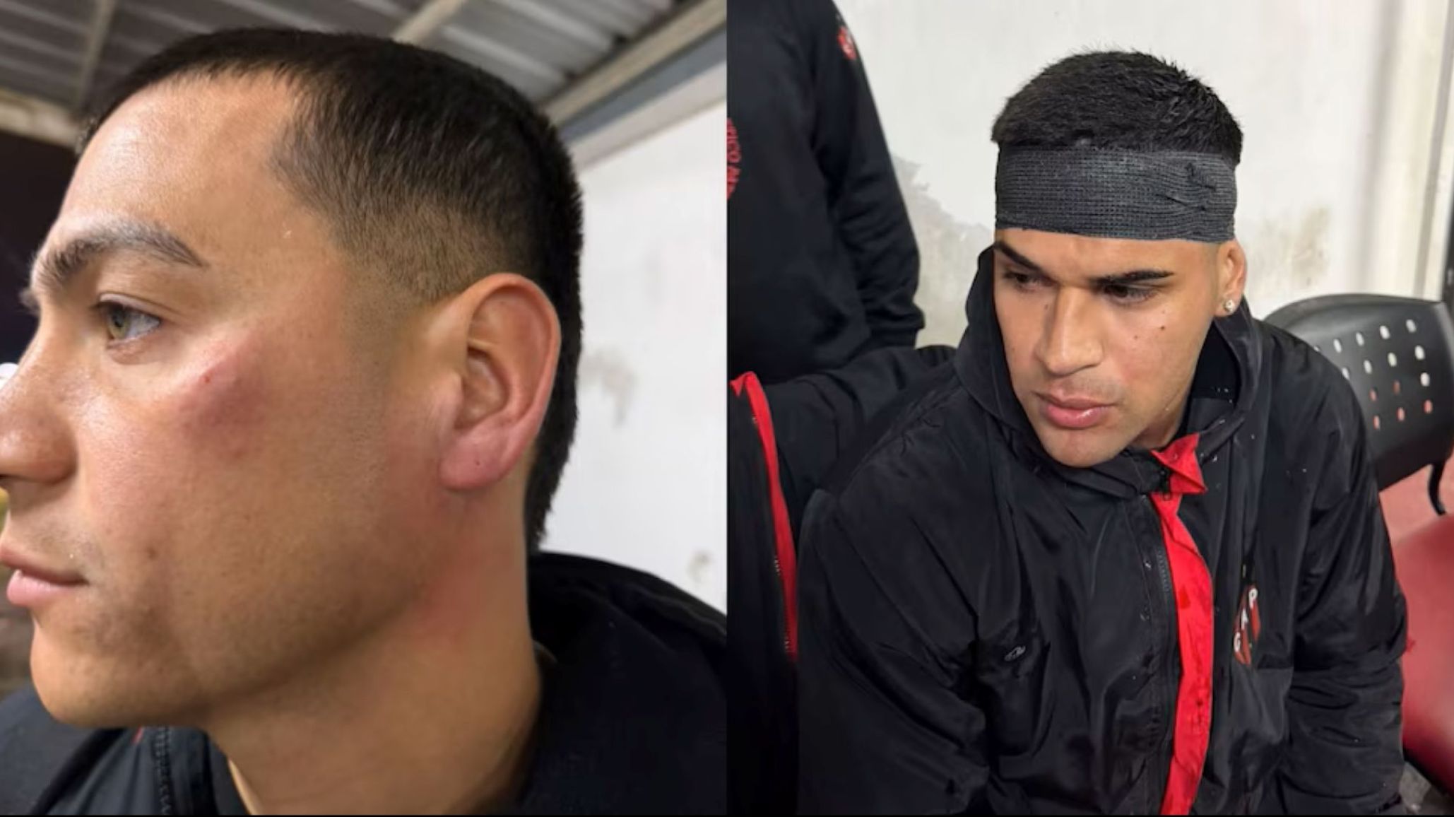 Escándalo en Patronato: agredieron a jugadores tras la derrota ante Colón
