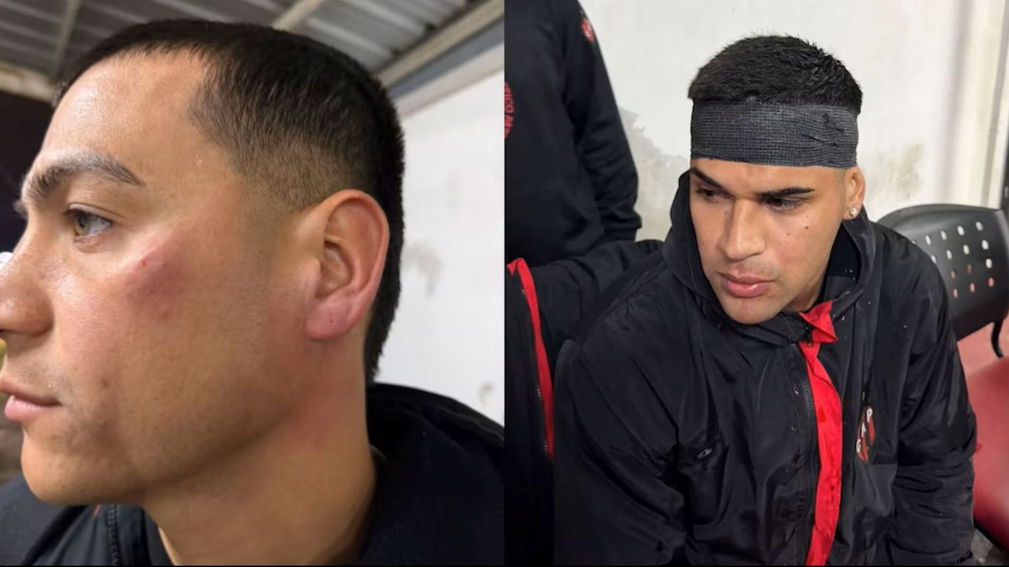 Escándalo en Patronato: agredieron a jugadores tras la derrota ante Colón