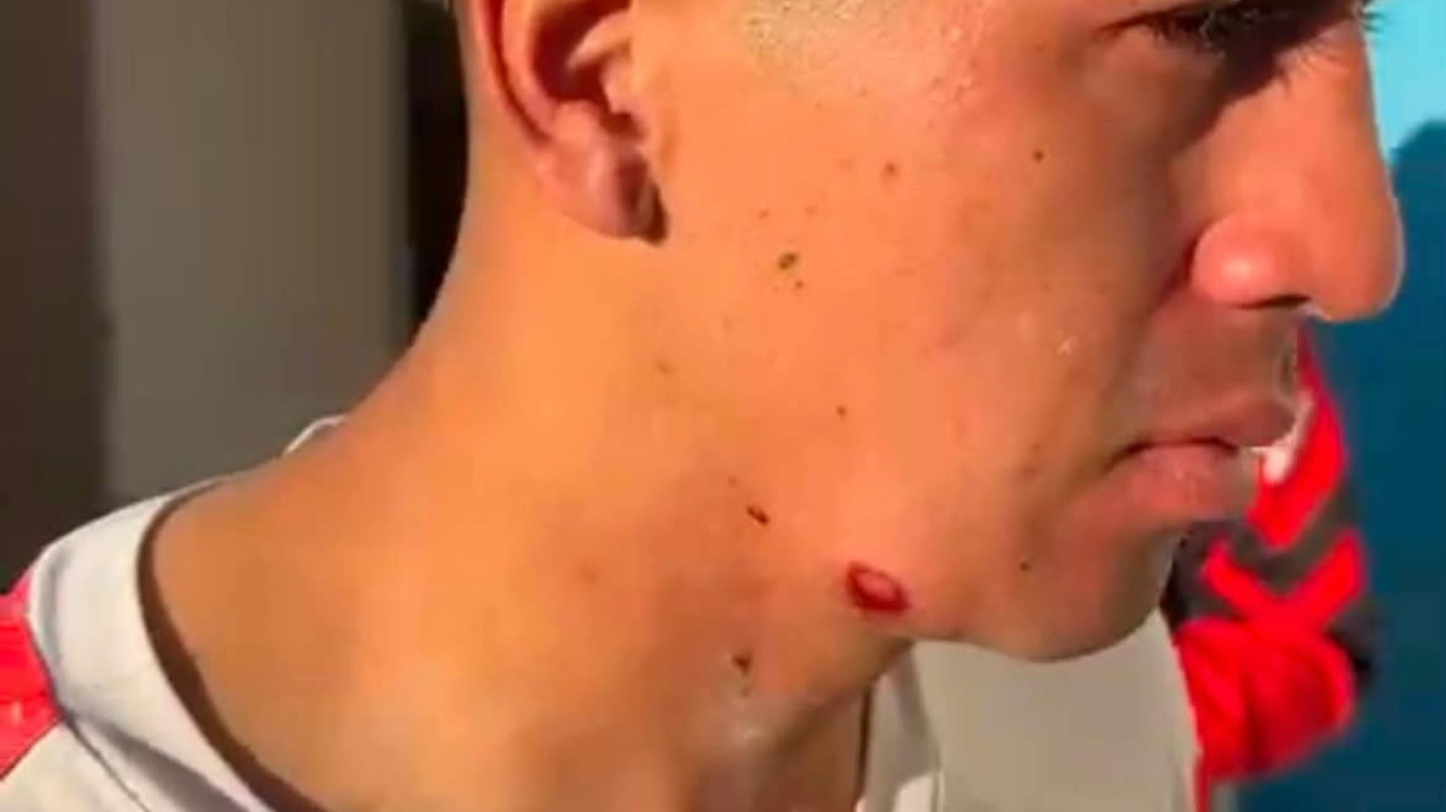 Huracán denunció que un jugador recibió un disparo de bala de goma por parte de la Policía tras el partido con Laprida