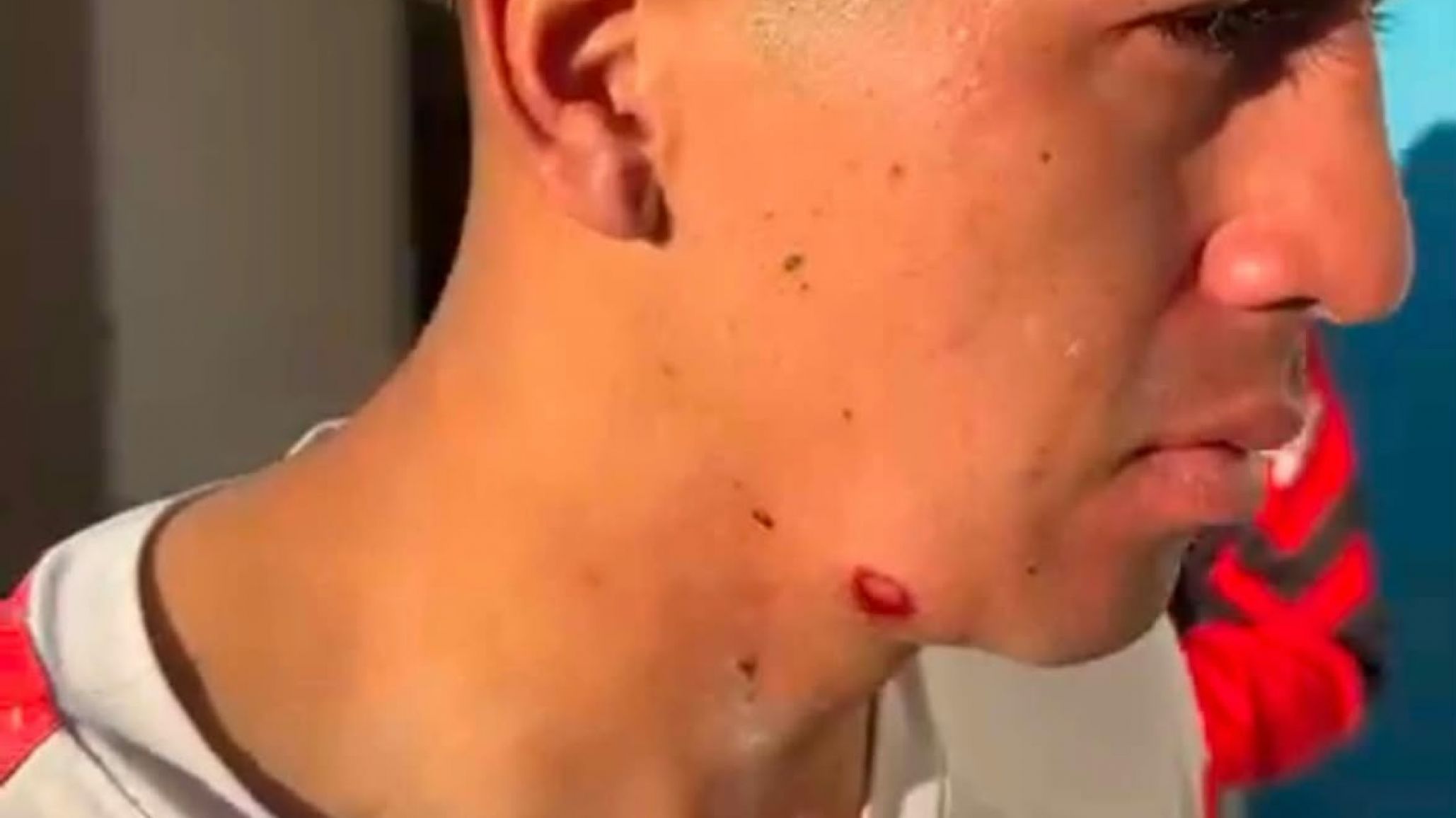 Huracán denunció que un jugador recibió un disparo de bala de goma por parte de la Policía tras el partido con Laprida