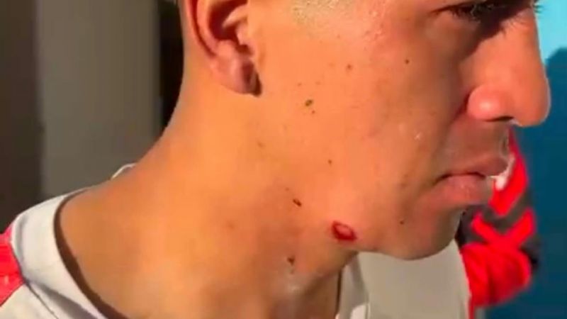 Huracán denunció que un jugador recibió un disparo de bala de goma por parte de la Policía tras el partido con Laprida