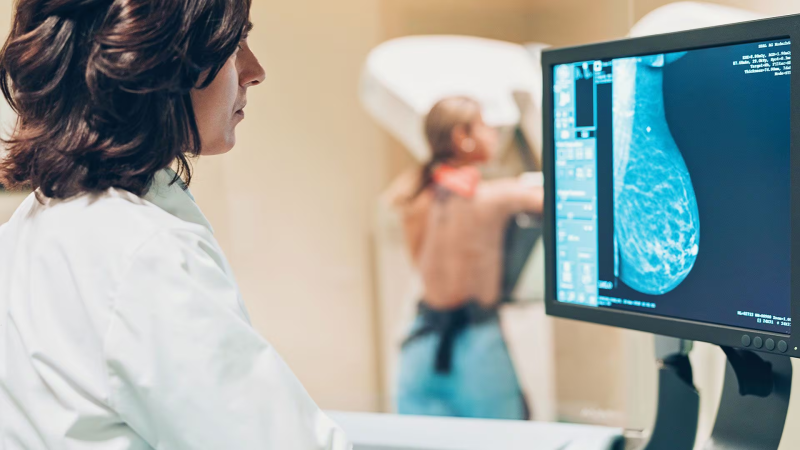 APAEC lanza una nueva campaña gratuita de mamografías para mujeres sin obra social