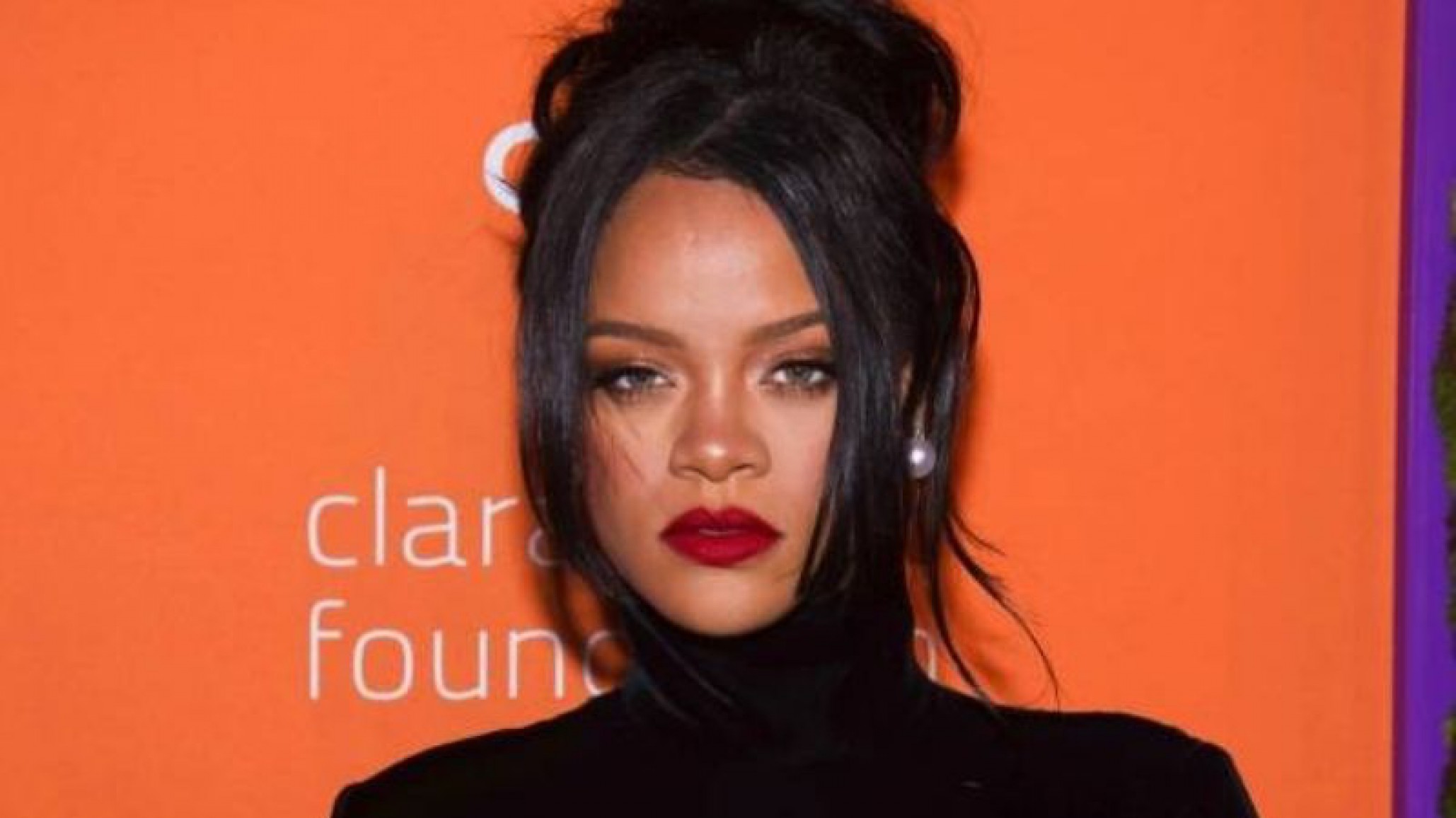 Conmoción entre los fanáticos de Rihanna por el estado de sus piernas