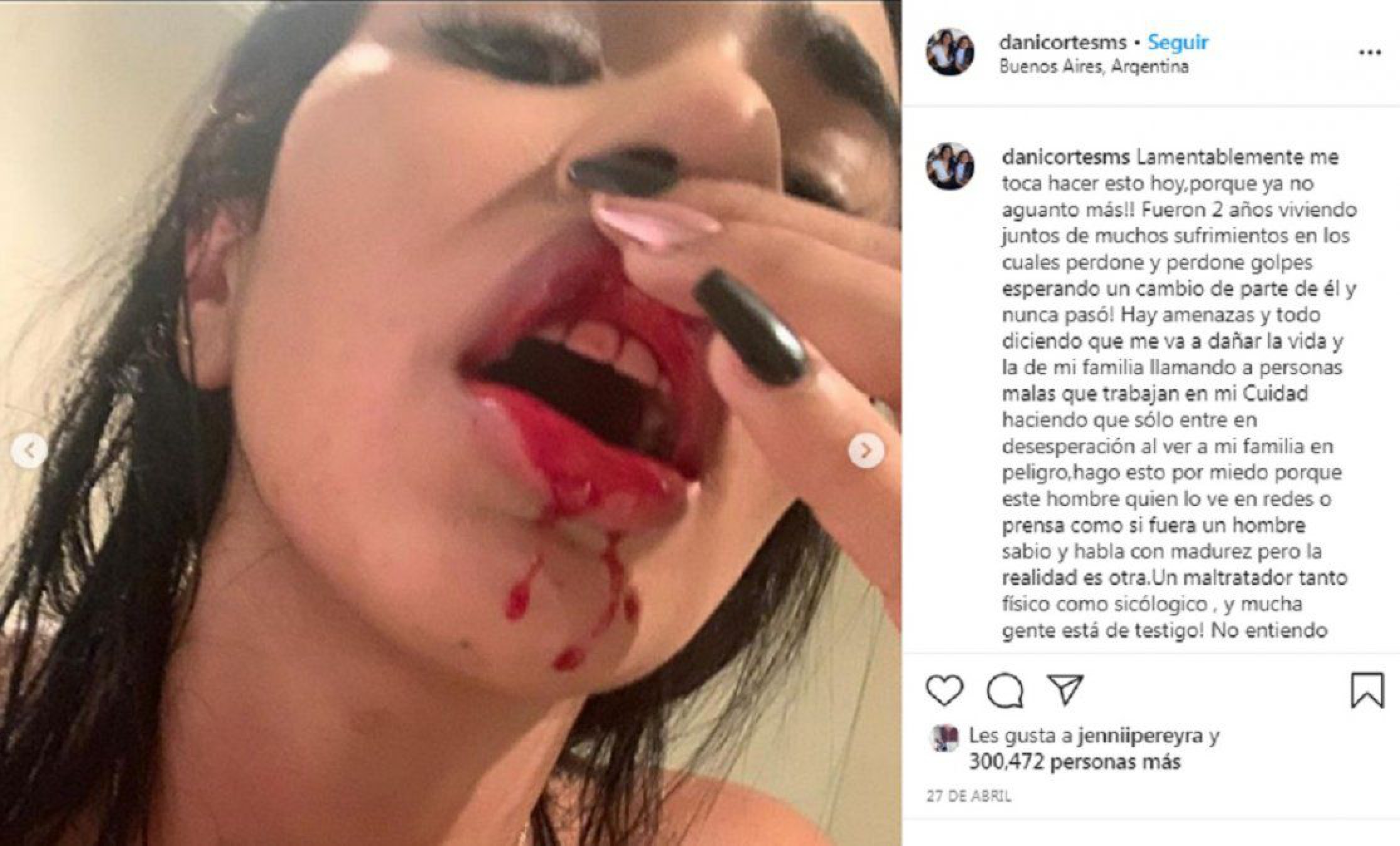 Violencia de género: Fernando Burlando logró un nuevo paso contra Sebastián Villa