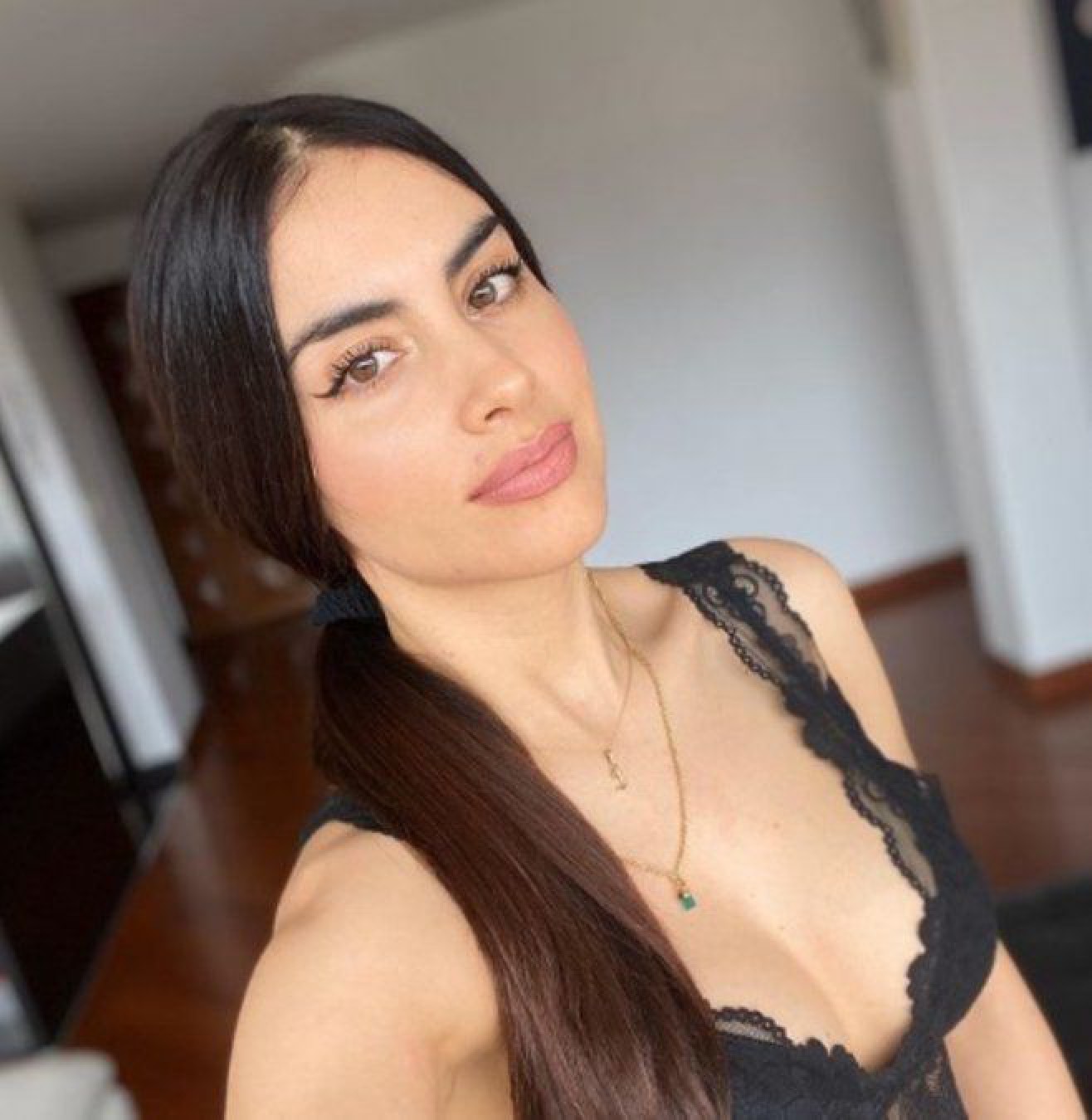 Jéssica Cediel se solidarizó con Daniela Álvarez por la amputación de su pierna