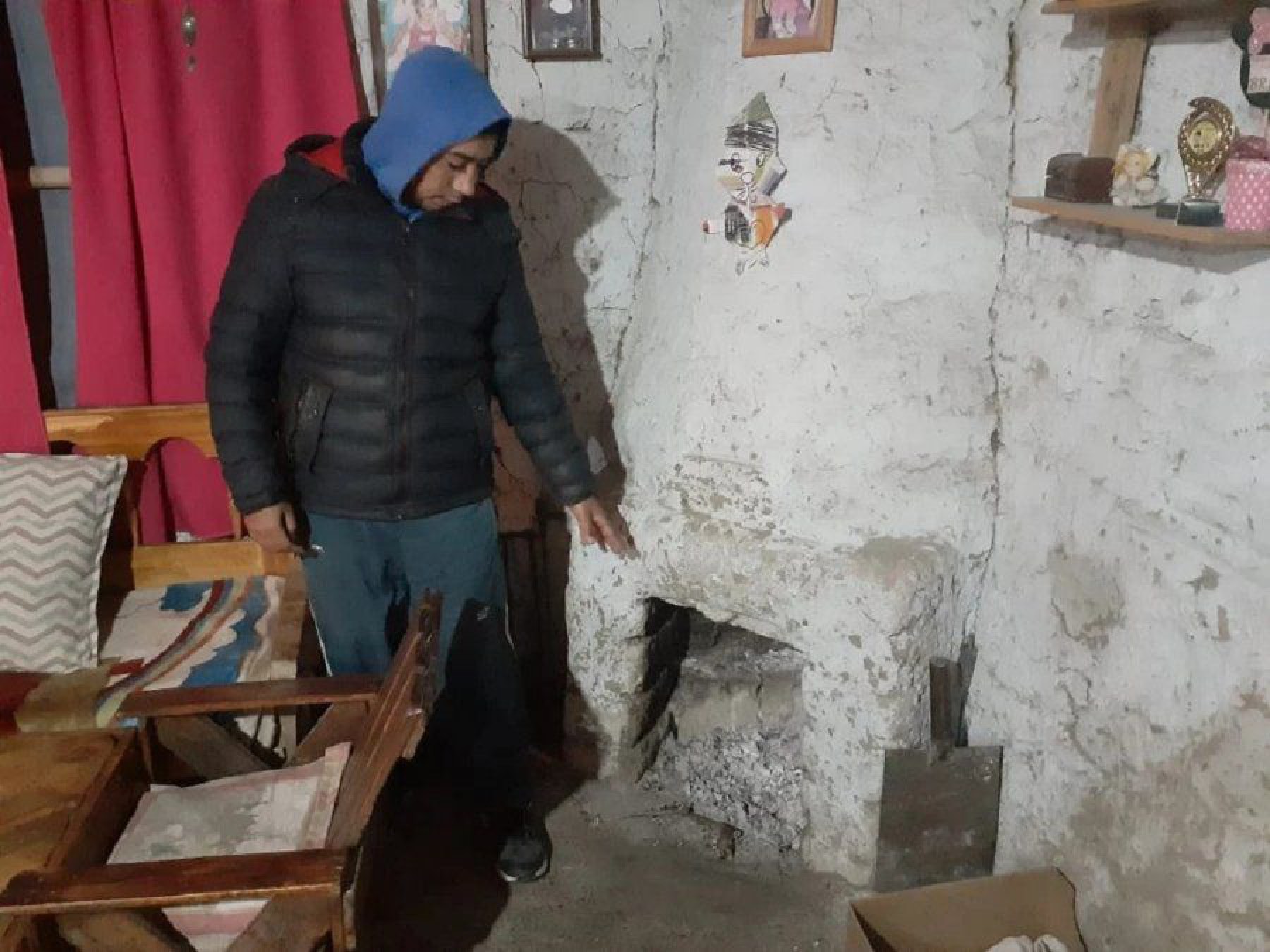 Niña de 7 años se quemó el 50% del cuerpo en un accidente