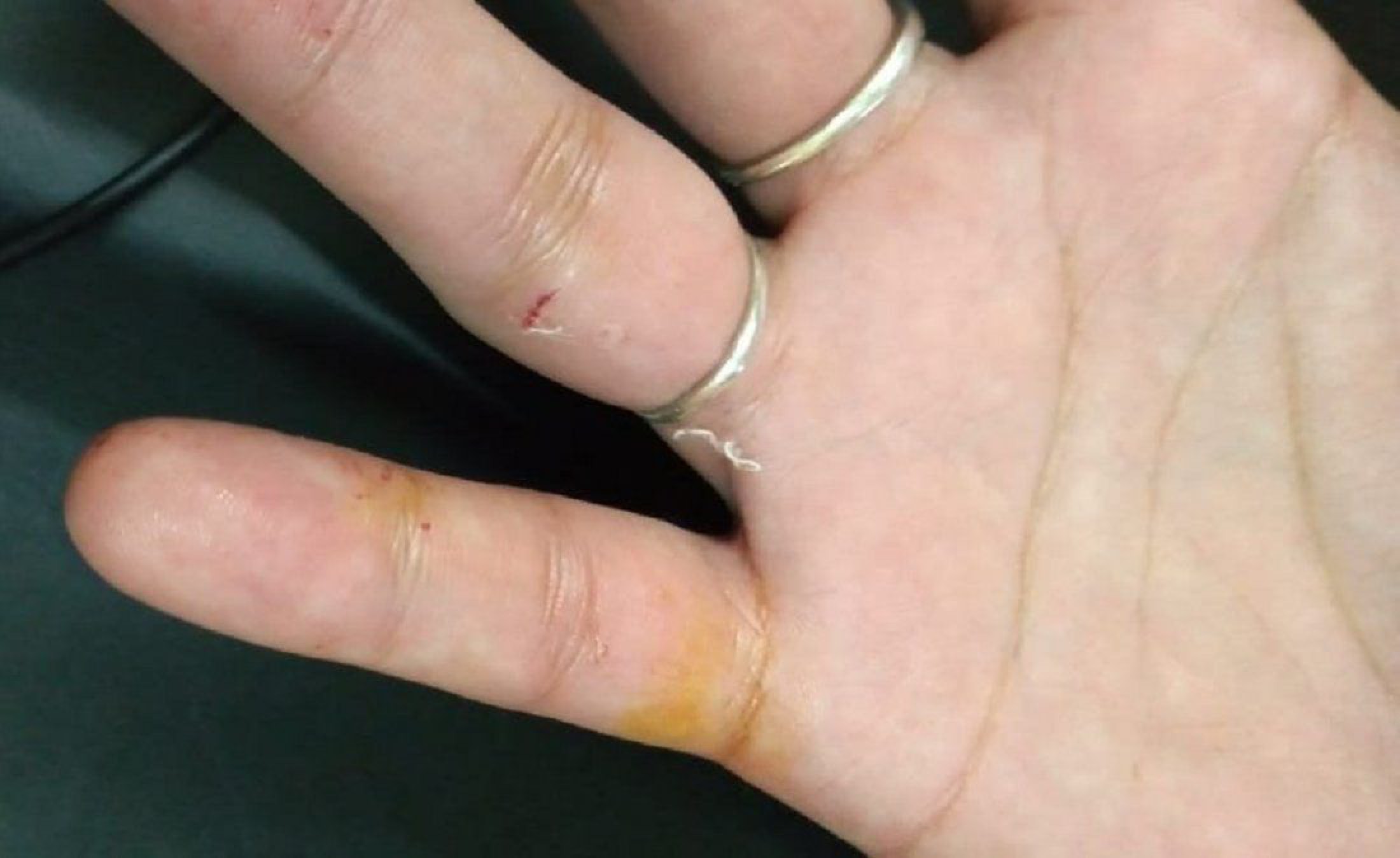 Chica de 14 años hirió a una mujer con un cuchillo de carnicero para robarle el celular